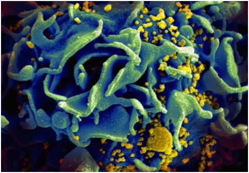 视频大鸡巴操大逼开发出靶向HIV病毒库的Dual-CAR-T细胞,为治愈HIV感染奠定基础
